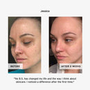 Day + Night Hyaluronic Cream