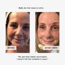 Retinol Night Cream