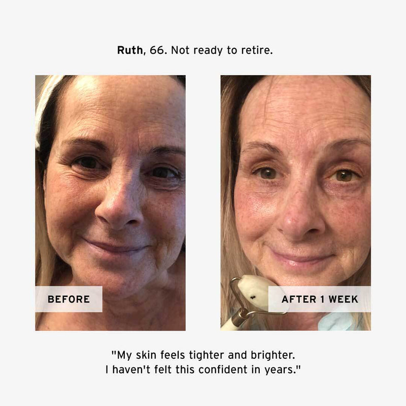 Retinol Night Cream